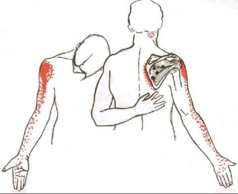 Why does your back hurt around the right shoulder blade when you take a deep breath?