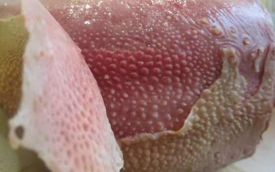 Tongue peeling off skin
