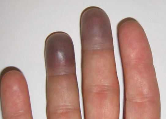 Purple-fingertips
