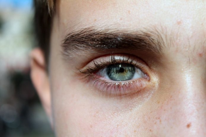 eyebrow-dandruff-causes-treatemenent-home-remedies