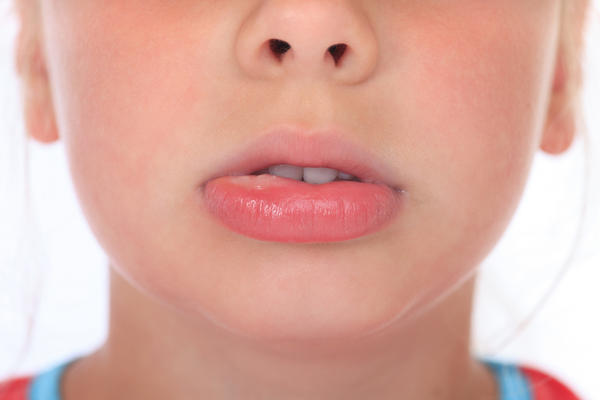 Swollen Lips, Causes and Treatments