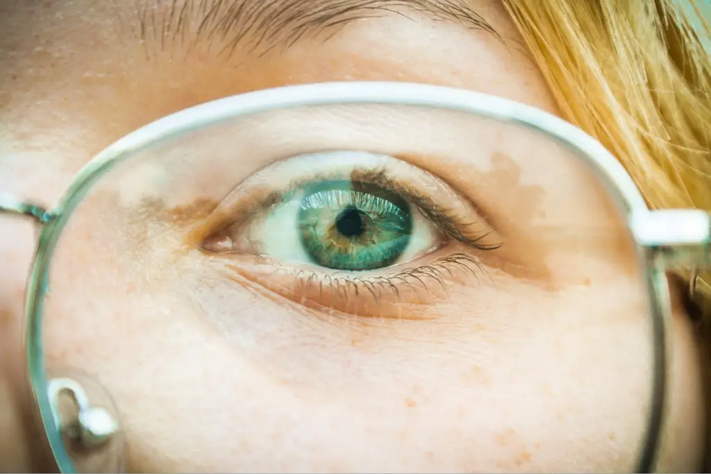 Ditch Your Glasses and Consider LASIK